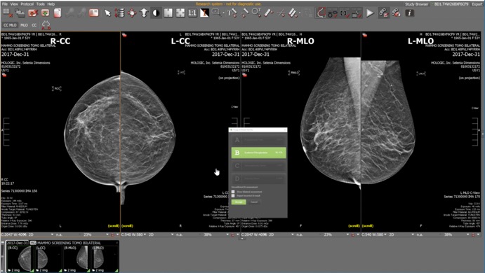 BD AI classifier